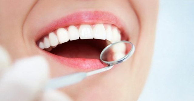 Sau khi sử dụng phương pháp bọc răng sứ khắc phục tình trang răng thưa nên thăm khám định kỳ