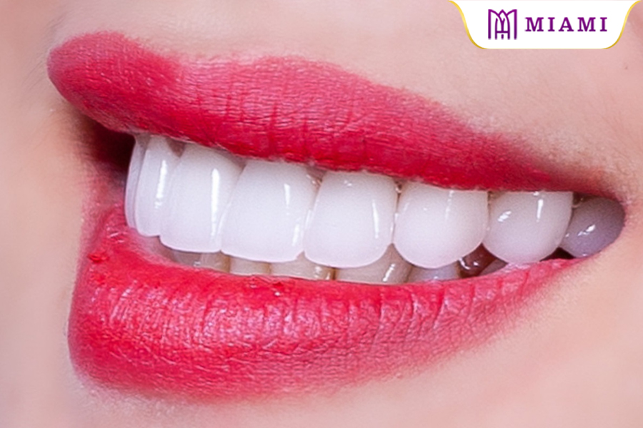 Răng sứ DMax mang đến vẻ đẹp hàm răng tinh tế